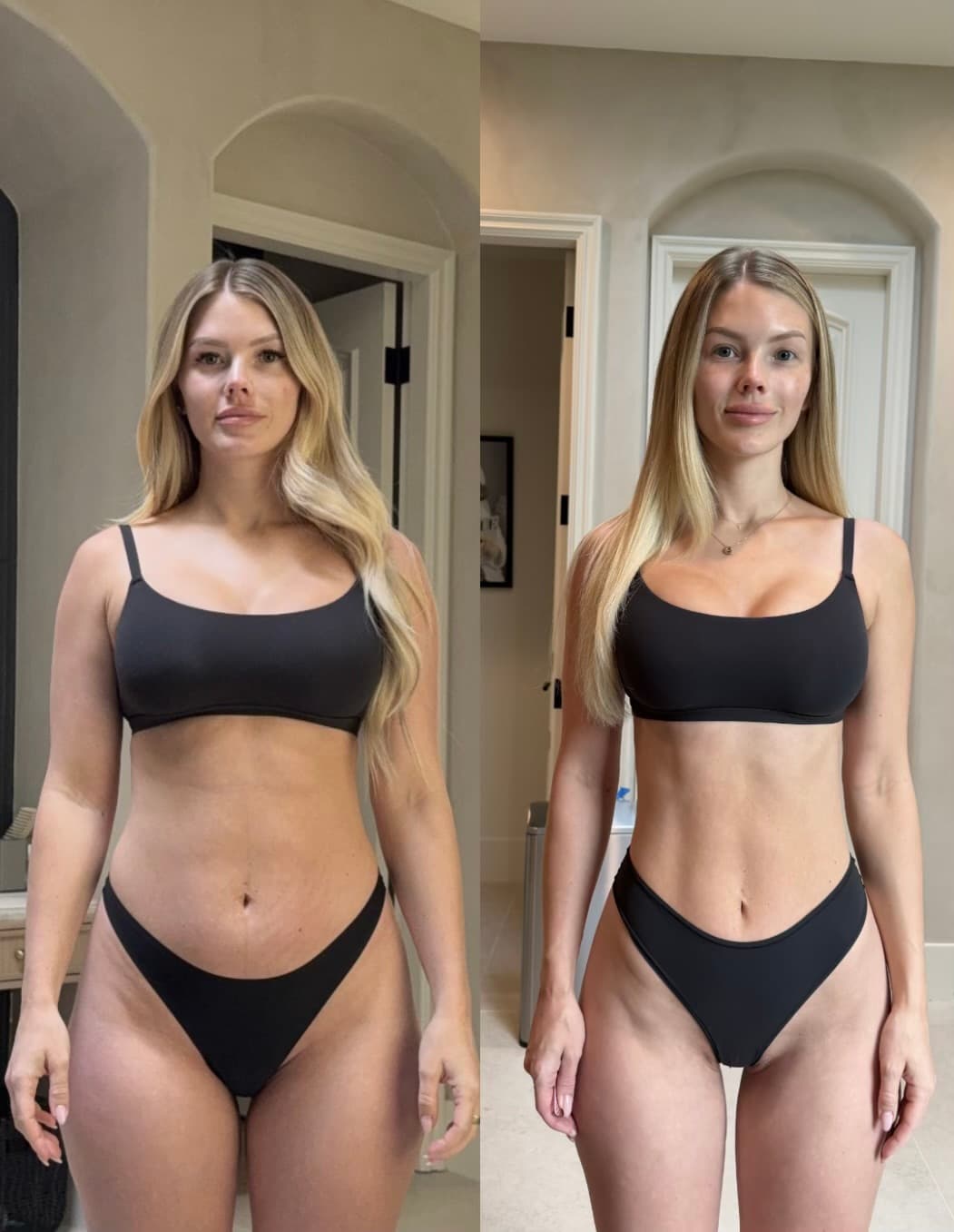 Front view, before and four months postpartum